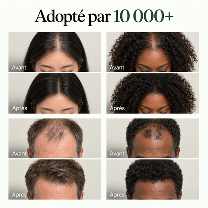 Shampoing Renaissance Cuir Chevelu Meora